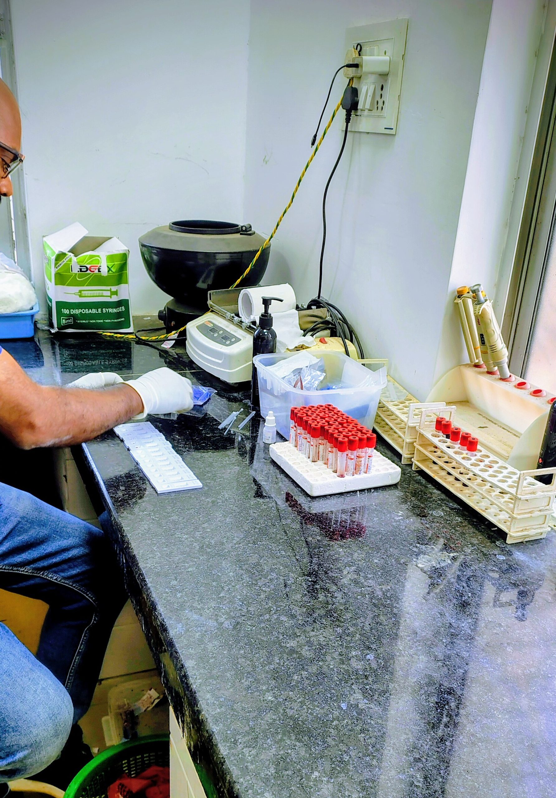 Laboratorio de diagnóstico: muestras de sangre y kits de prueba rápida para sífilis (imagen de archivo)